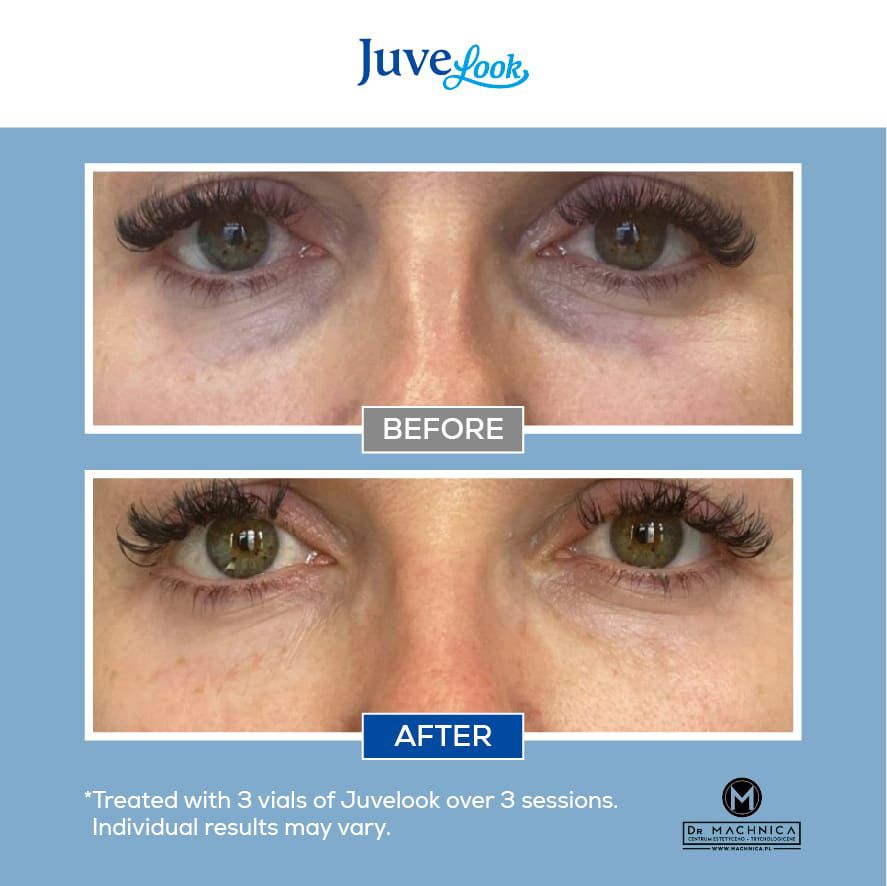 1326b8b3-20d1-43a1-b45f-b3de089d6b19