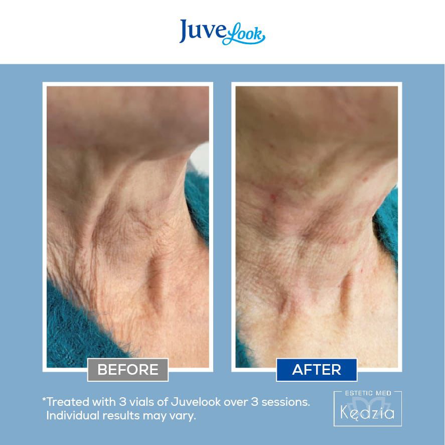 ff1687b8-c624-47a6-ba43-75fba11880f2